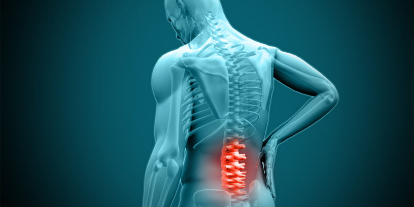 What Is A Herniated Disc? - Symptoms, Causes And Treatment - Atlanta ...